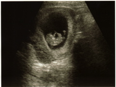 1st Ultrasound - 3